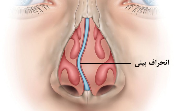 عکس داخل بینی انسان