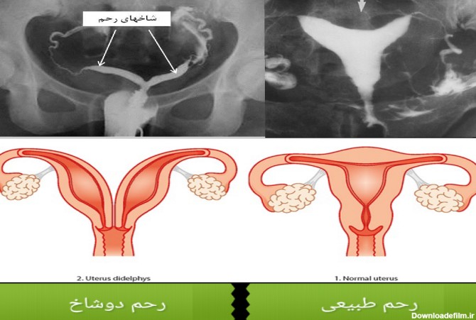 عکس رنگی رحم کجا انجام میدن