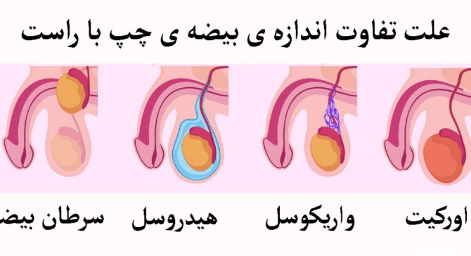 عکس بیضه طبیعی نوزاد