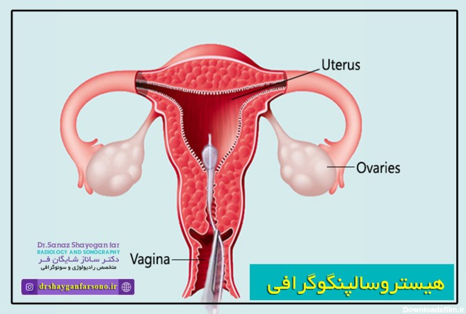 عکس دستگاه عکس رنگی از رحم