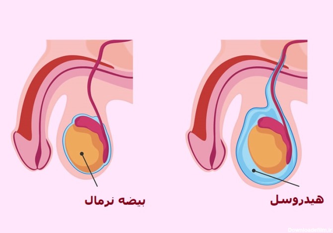 عکس بیضه سالم کودک