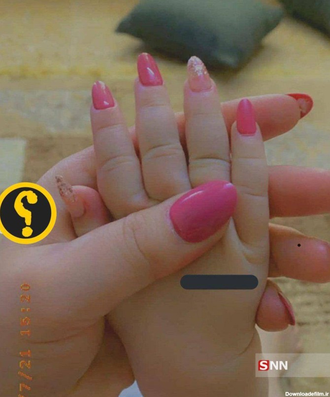 عکس ناخن کاشت ناخن