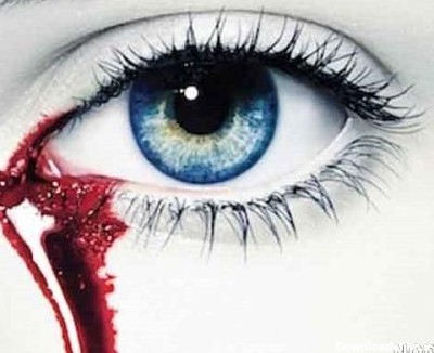 عکس پروفایل چشم پر از خون