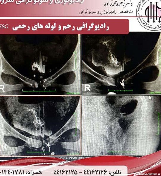 مراکز عکس رنگی رحم در همدان