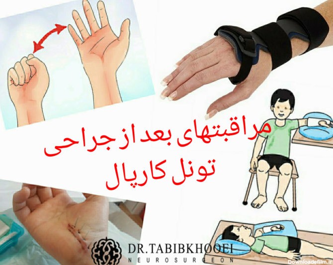 عکس مچ دست نی نی سایت