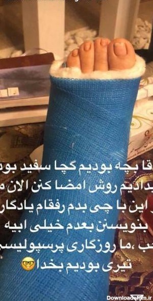 عکس پروفایل پا شکسته