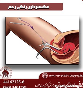 فیلم عکس رنگی گرفتن از رحم