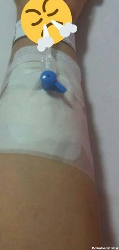 عکس دست سرم وصل شده