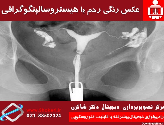 نحوه گرفتن عکس رنگی از رحم نی نی سایت