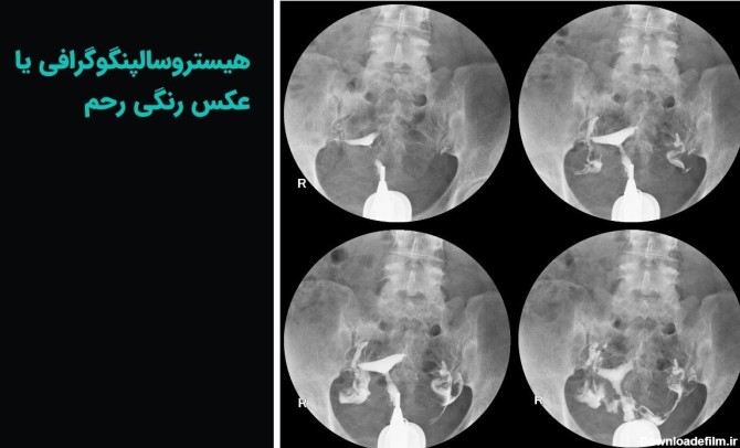 بهترین مرکز عکس رنگی رحم اصفهان