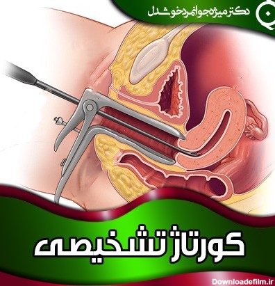 كورتاژ تشخيصي عکس ضخیم شدن دیواره رحم