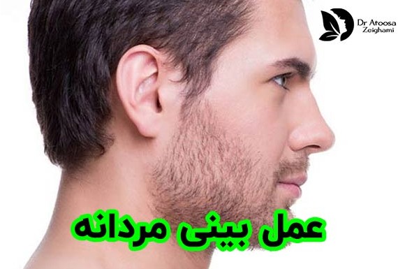 عکس بینی طبیعی مردانه