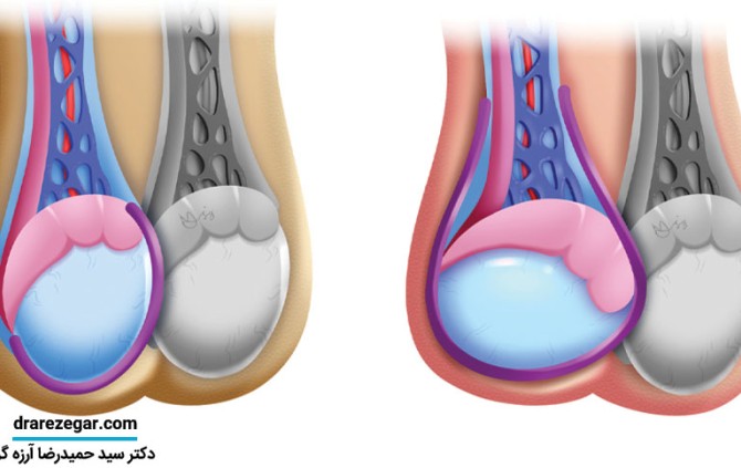 عکس بیضه نوزاد سالم