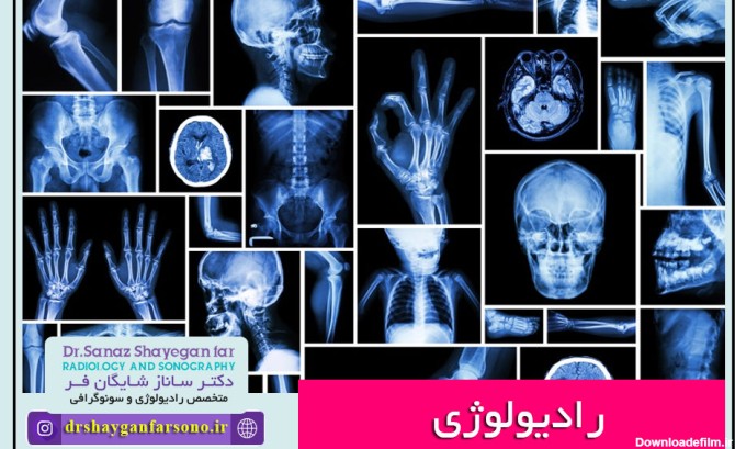 مراکز عکس رنگی از رحم در اصفهان