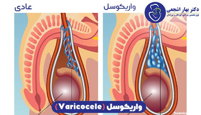 عکس بیضه سالم و ناسالم نوزادان