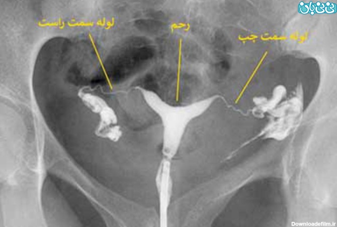 عکس رنگی رحم و باردار شدن