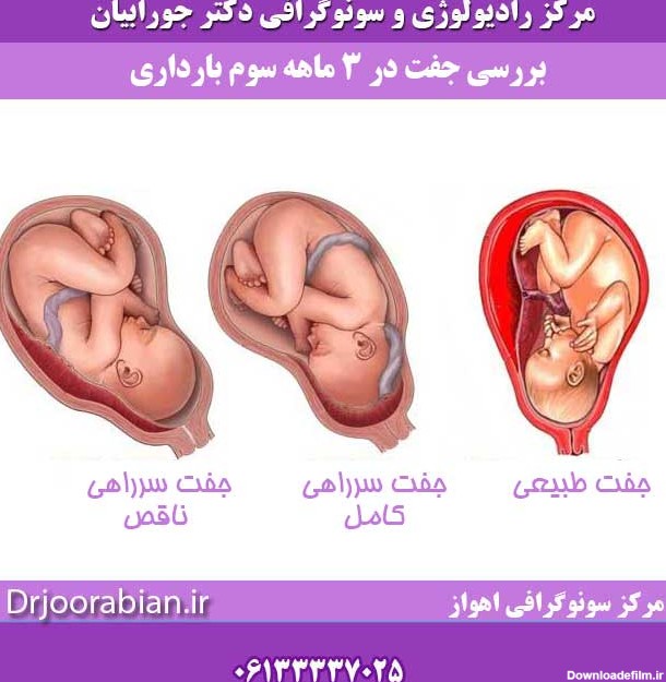 عکس جنین سه ماهه در شکم