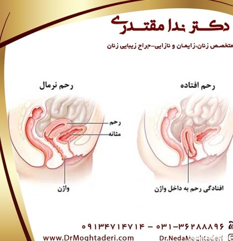 عکس رحم زن طبیعی