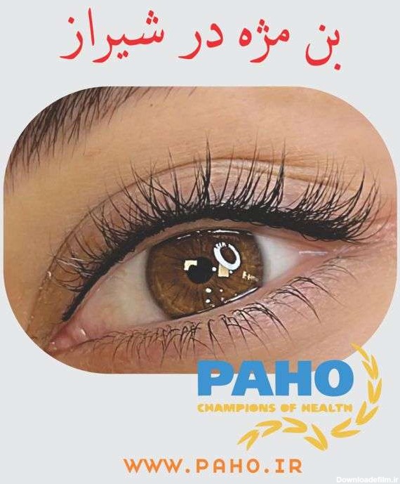 عکس رنگی چشم در شیراز