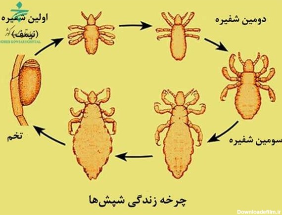 عکس شپش سیاه کوچک