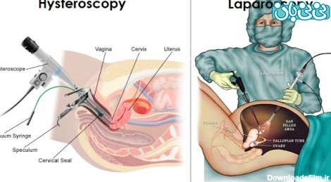 عکس رنگی رحم چند دقیقه طول میکشد