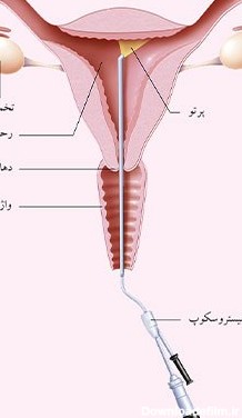 مرکز عکس رنگی رحم در کرج