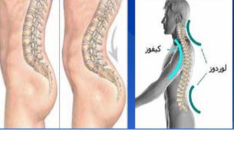 عکس های گودی