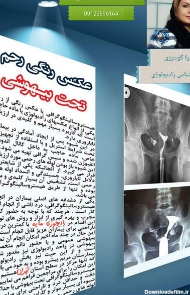 عکس رنگی از رحم در اسلامشهر