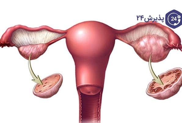 عکس تخمدان مرد