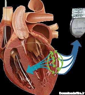 عکس باتری در قلب